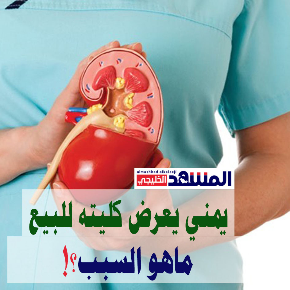 مهندس نفط يمني يعرض كليته للبيع ويؤكد: الموضوع جاد وليس للإستهلاك