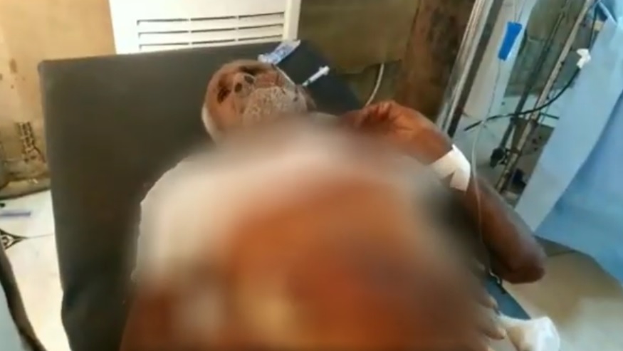 اصابة 3 مواطنين بقصف حوثي على حي جنوب الحديدة (فيديو)