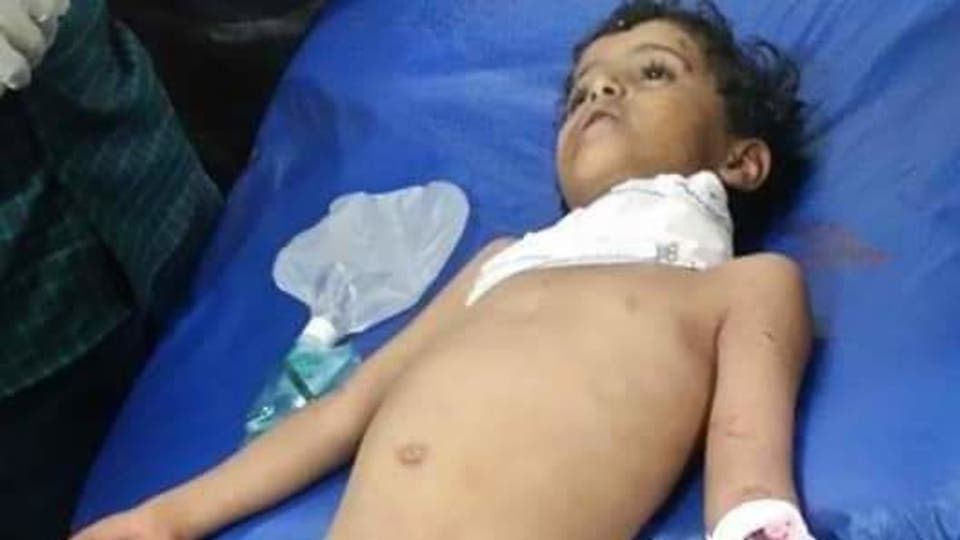 صور صادمة.. قصف حوثي لم يرحم طفل في السادسة من عمره