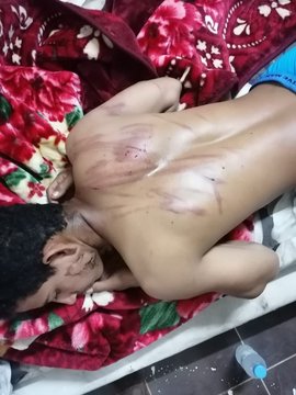 الشرطة السعودية تضبط 4 متهمين بالاعتداء على مقيم يمني