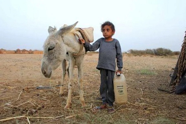 صبي يمني يكافح سوء التغذية وشبح الجوع يطارد أطفال البلاد