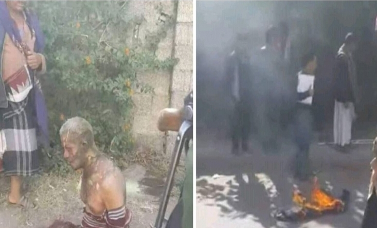 بعد احتجاز ولده من قبل مليشيا الحوثي مواطن يحرق نفسه في محافظة إب