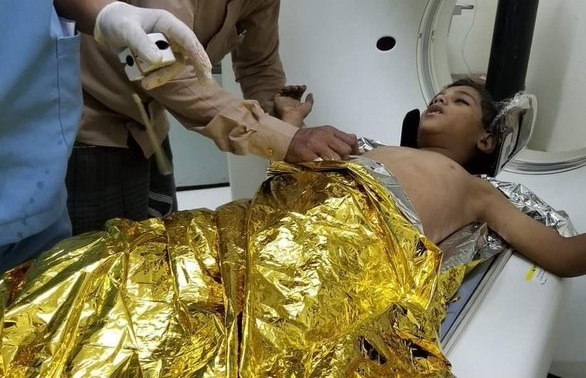 وفاة طفل متأثراً بجراح أصيب بها إثر سقوط قذيفة حوثية على منزلهم في تعز