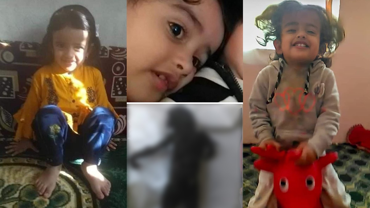 صورة الطفلة المتفحمة بمأرب جراء قصف حوثي.. تصدم اليمنيين - شاهد