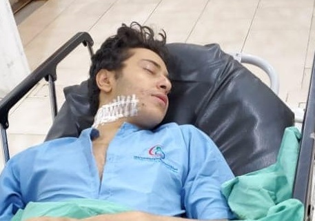 أمن صنعاء يكشف هوية المتهم بمحاولة إغتيال الفنان الشعراني