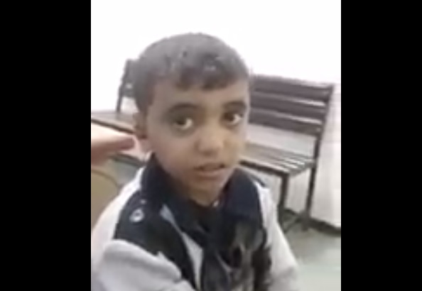 طلب من زوجة أبيه الذهاب إلى أمه فعذبته وأحرقت جسده..جريمة مروعة بحق طفل في اليمن (فيديو)