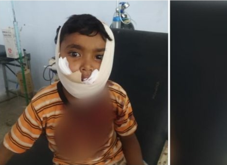العميد طارق يقوم بهذا العمل الإنساني تجاة طفل "حيس" الحديدة