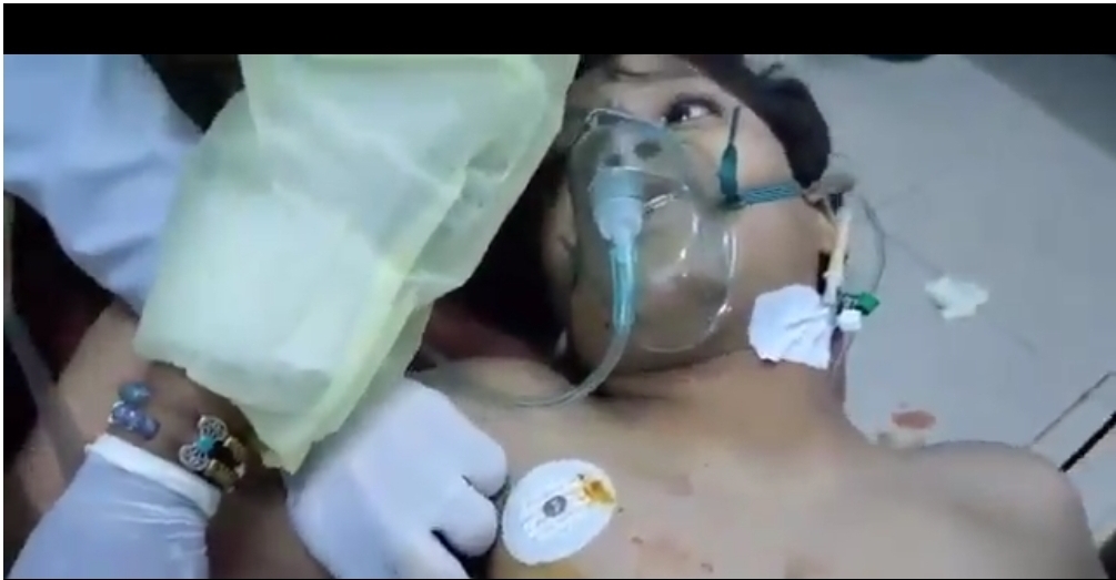 اقتطع النفس ..آخر كلمات طفل قتله صاروخ حوثي في مأرب"فيديو"