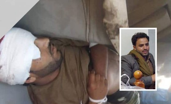 باشره برصاصة في رأسه.. مسلح حوثي يقتل شاباً بسبب قطرات ماء وقعت على ثيابه - صورة