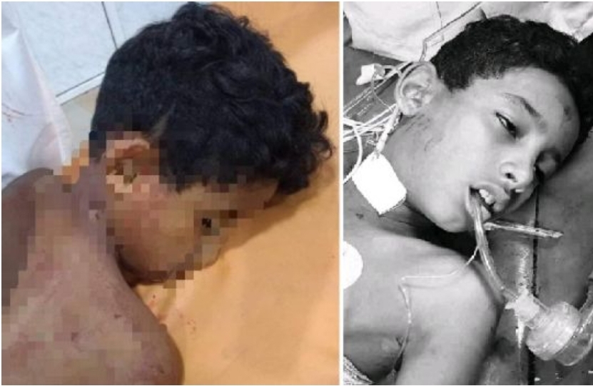 في مشهد مؤثر..مسلح حوثي يقتل طفلاً يبيع مناديل ورقية وسط مدينة إب 