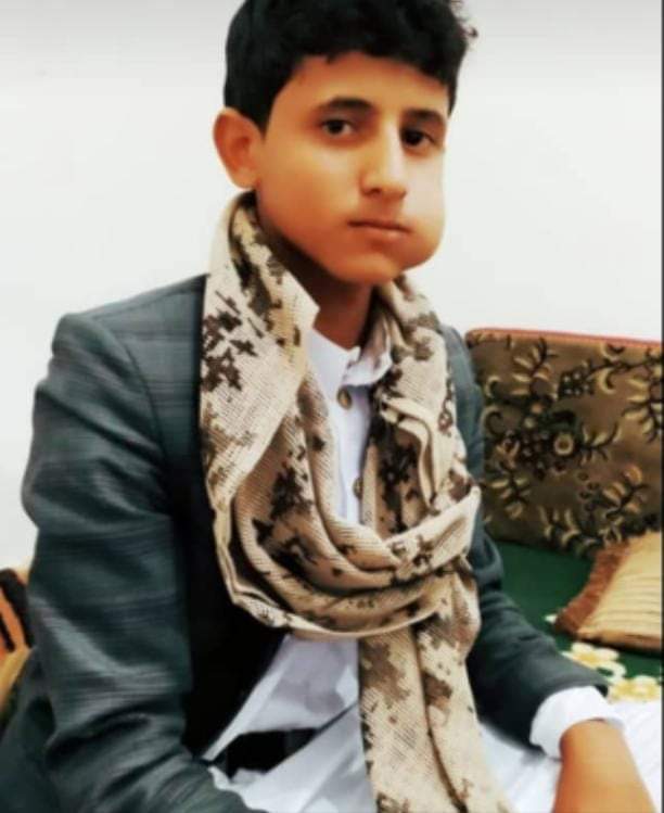 ناطق "المشتركة" يكشف تفاصيل مصرع أصغر قيادي حوثي ومحاولات مستميتة لانتشال جثته (صورة)