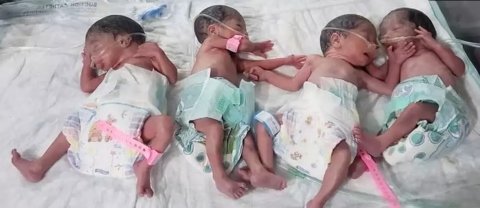 امرأة تنجب 4 توائم في صنعاء