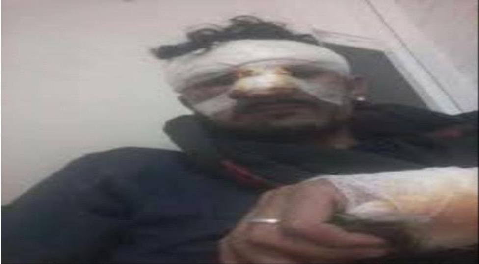 شاهد.. صورة لقيادي حوثي بعد عودته من مأرب التي هدد بدخولها وتطهيرها تثير مواقع التواصل الإجتماعي