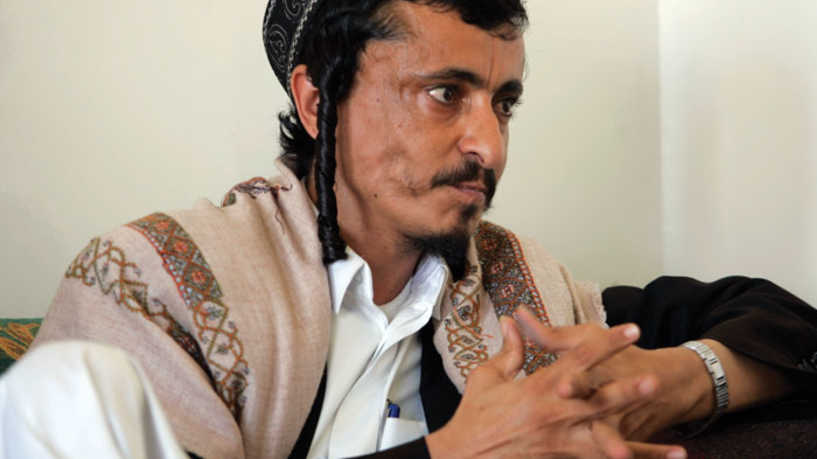 واشنطن تدعو لإطلاق سراح يهودي يمني