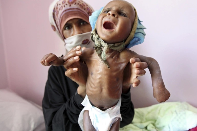 منظمة أممية تكشف عن احصائية مأوساوية جديدة في اليمن