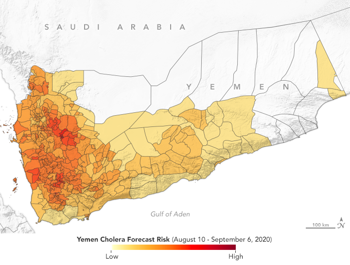 وكالة "ناسا" الاميركية تتوقع زيادة في عدد الاصابات بالكوليرا في اليمن