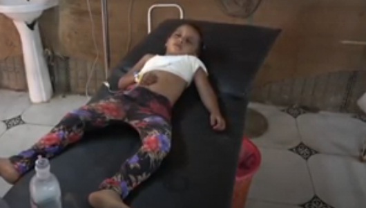 إصابة طفلة بشظايا قذيفة حوثية في الحديدة (فيديو)