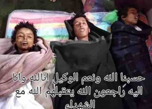 البيضاء.. مليشيا الحوثي ترتكب جريمة بشعه جديدة بقتل 3 أطفال