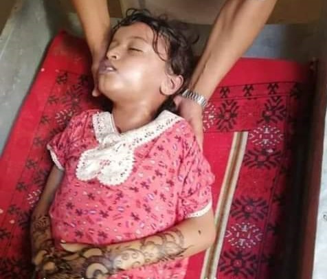 "الضنك" تودي بحياة طفلة في شبوة