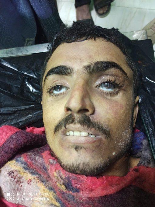 مصرع القيادي الحوثي عبدالوهاب محمد بدر الدين في مديريه الدريهمي