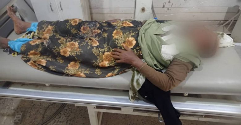 إصابة مسنة برصاص حوثي جنوب الحديدة