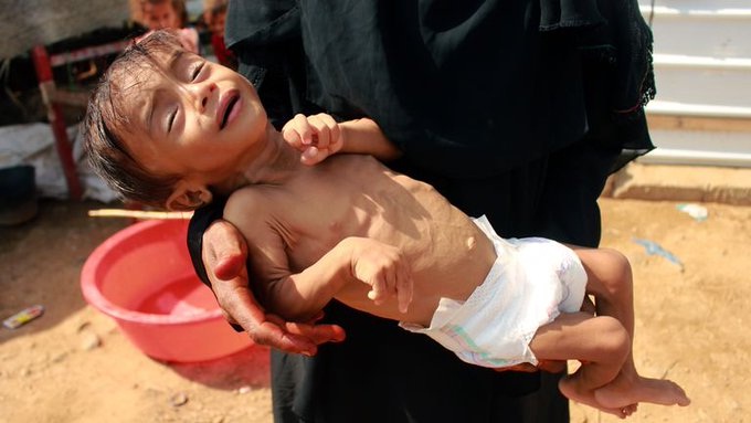 الفاو تحذر من مجاعة في اليمن وتدعو إلى استجابة انسانية عاجلة