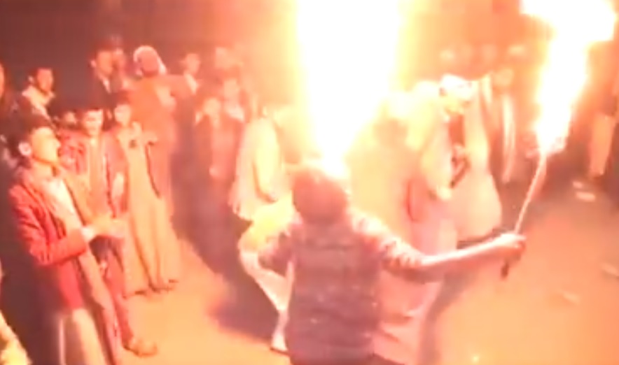 طفل يمني حاول إبهار حضور حفل الزفاف فأحرق نفسه والفنان يصرخ "طفوه طفوه ياشباب" (فيديو)