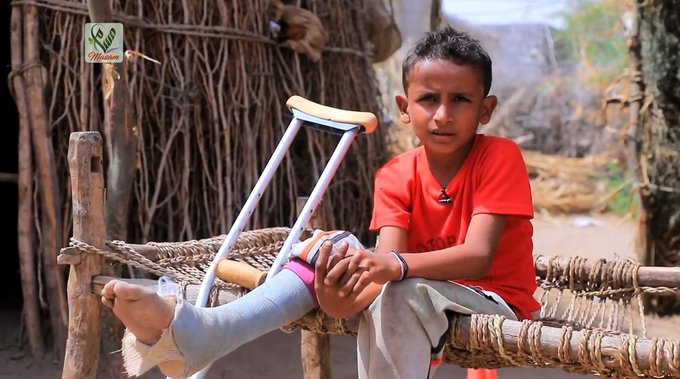 ألغام الحوثي تقتل 189 طفلا وتتسبب بإعاقة 291 آخرين في تعز