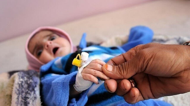 "الصحة العالمية": عالجنا 15 ألف طفل يمني من سوء التغذية الحاد خلال 15 شهرا
