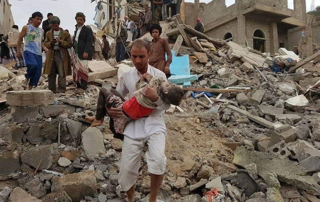مرصد دولي:اليمن أسوا أزمة إنسانية في العالم... طفل يموت كل 10دقائق