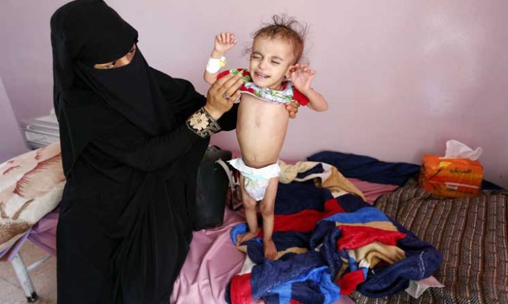 مليون حالة مصابة بالكوليرا في اليمن (منظمة)