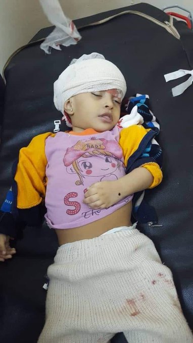 مقتل طفلة وإصابة 4 آخرين بقصف حوثي على الاحياء السكنية غرب تعز