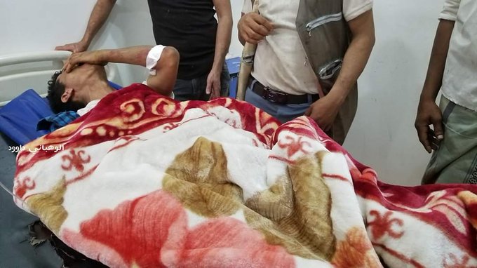 مقتل وإصابة 12 مدنيا بقصف حوثي على منطقة سكنية غرب تعز 