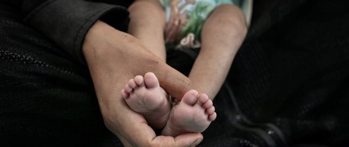 الامم المتحدة تحذر: 5 ملايين يمني على بعد خطوة من المجاعة 