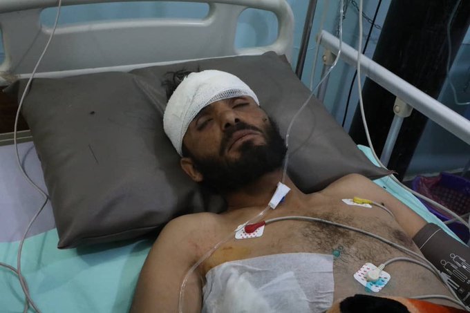 القوات الحكومية تأسر القيادي الحوثي "ابو محمد القاسمي" في الجوف (صورة)