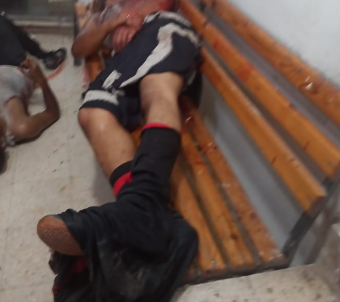 10 قتلى وجرحى حصيلة أولية للهجوم الحوثي على قاعدة عسكرية جنوب اليمن