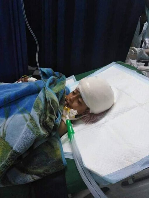 وفاة طفل متأثراً بجراح أصيب بها إثر هجوم صاروخي في الضالع (الاسم+صورة)