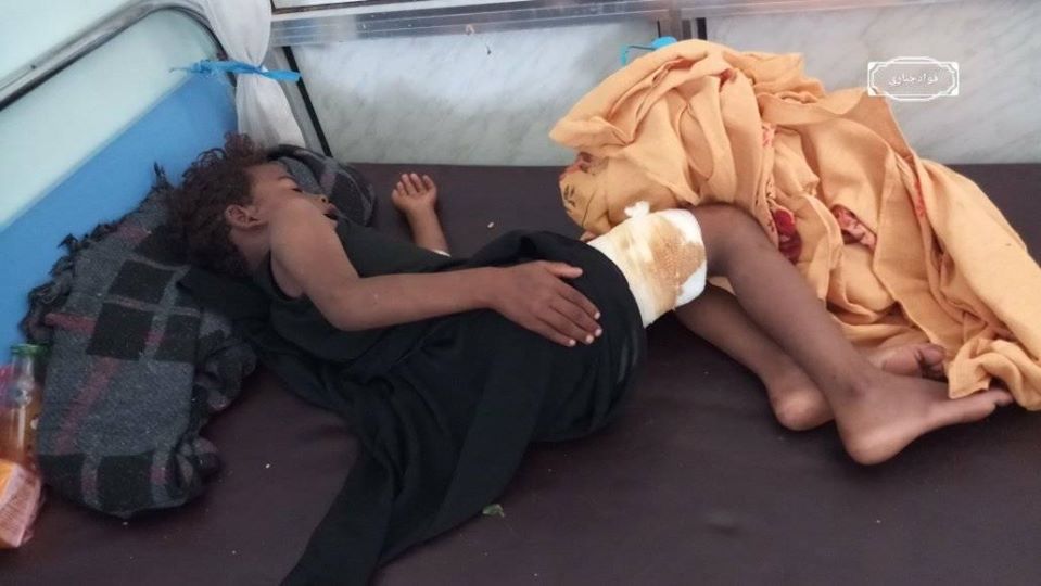 مقتل طفلة واصابة اثنين آخرين بمقذوف حوثي في الضالع