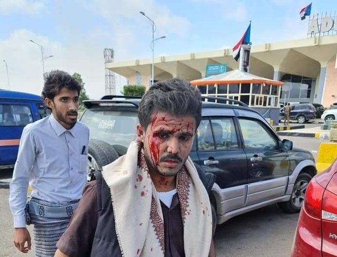 وزير الصحة: 25 قتيلا و110 جرحى ضحايا هجوم مطار عدن "والعدد مرشح للتصاعد"