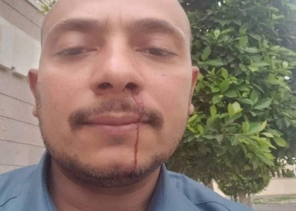 قيادي حوثي يعتدي على مسؤول في جامعة بصنعاء