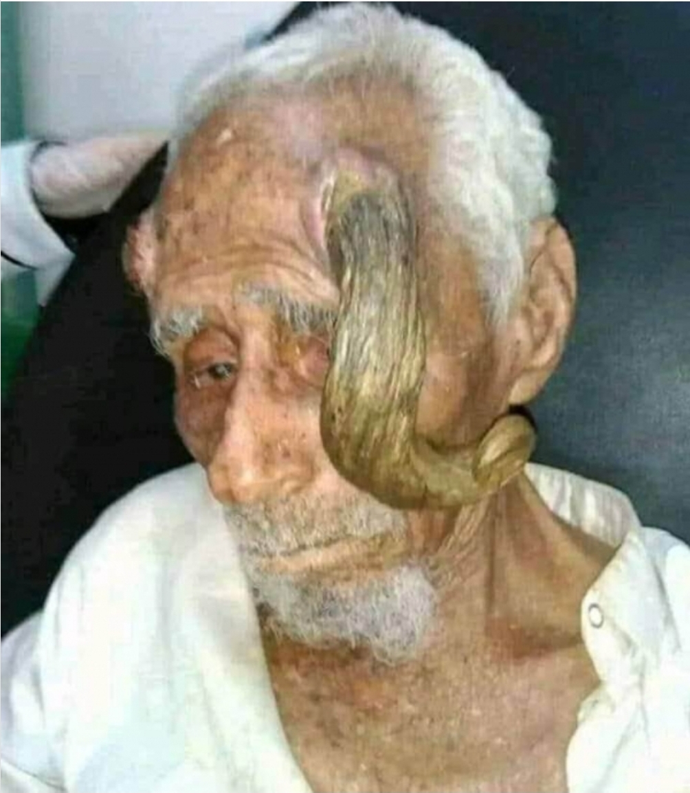بعمر 140...وفاة المعمر اليمني علي عنتر، الملقب بـ"ذي القرنين"