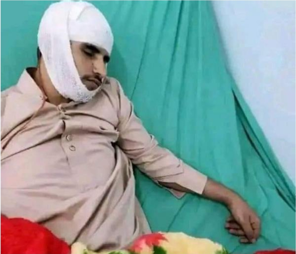 وسط استياء وسخط ...أب يقدم على ضرب إبنه الكفيف بالفأس على رأسه 