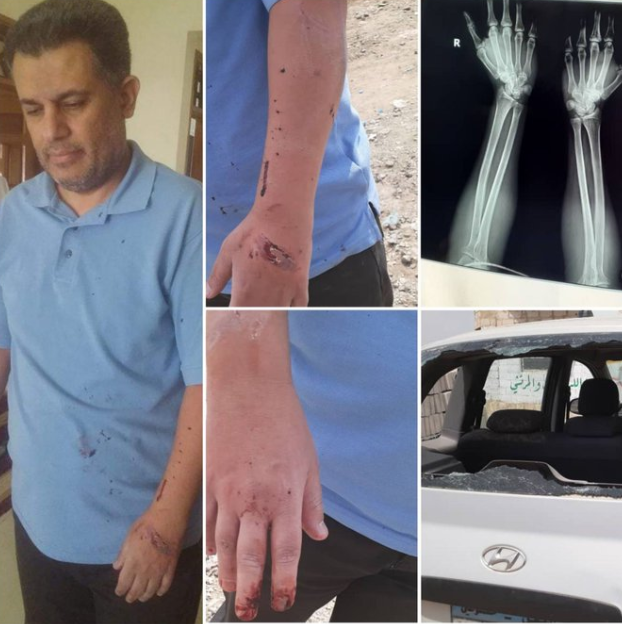 عناصر من ميليشيا ايران تعتدي بشكل وحشي على اكاديمي في جامعة صنعاء