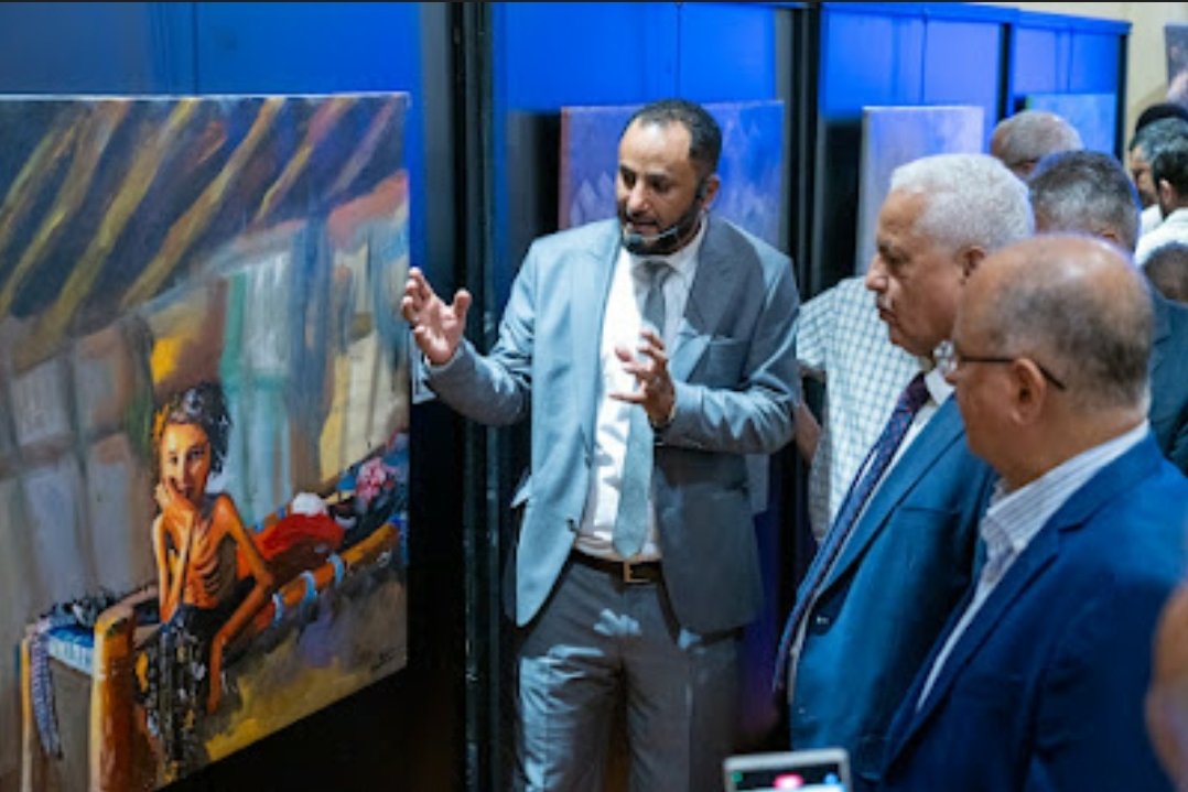 معرض في تركيا عن حصار تعز