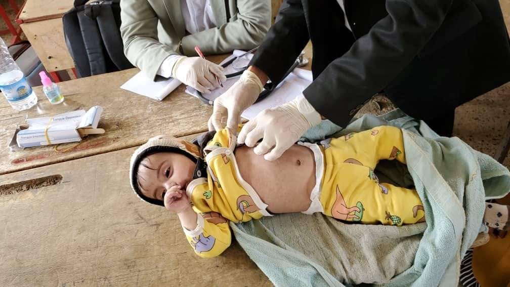 بيانات أممية: وفاة 259 يمنيا وإصابة أكثر من 25 ألف آخرين بمرض الحصبة منذ مطلع العام الجاري