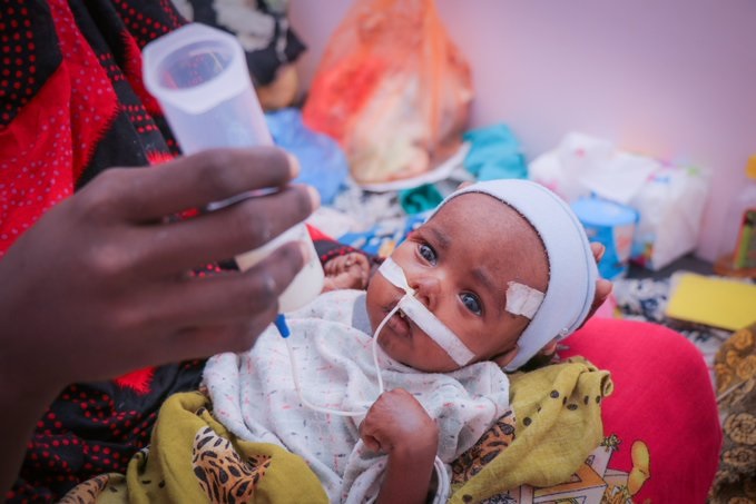 يونيسف: 2.2 مليون طفل دون الخامسة في اليمن بحاجة إلى العلاج من سوء التغذية الحاد