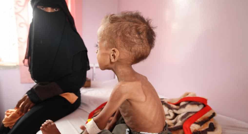 منظمة دولية: اليمن يحتل أعلى المراتب في قائمة البلدان الأكثر تضررا من انعدام الامن الغذائي